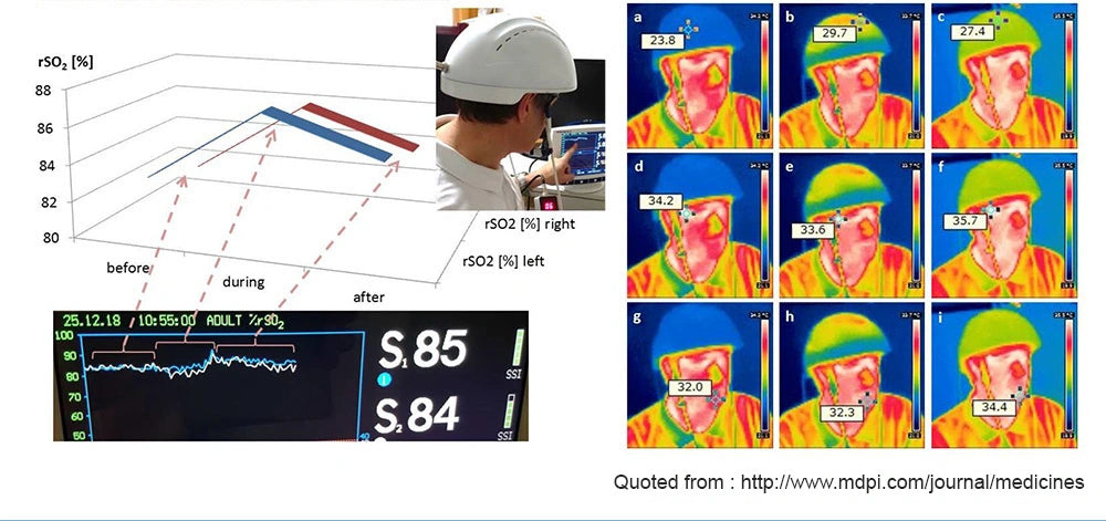 dr fuji brain helmet test results